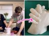 How to Cast Your Hands With A Couple Casting Kit